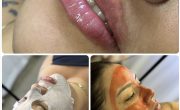 15% off – Clínica da enfermeira esteta Eduarda Mazalli faz aniversário com descontos para comerciários